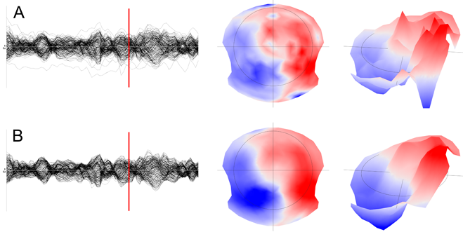 spatial filter